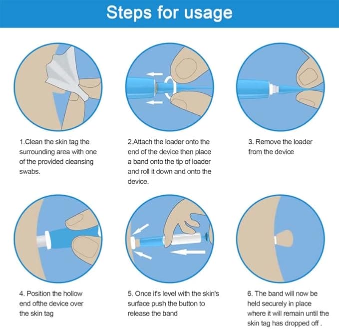 Skin Tag Remover, 2 In1 Painless Auto Skin Tag Remover, Mole Wart Removal Kit, Micro Skin Tag Remover Skin Tag Remover, 2 In1 Painless Auto Skin Tag Remover, Mole Wart Removal Kit, Micro Skin Tag Remover